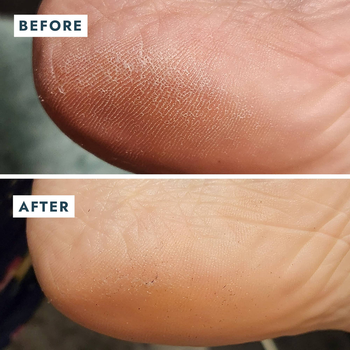 Heel Repair Duo - Mint